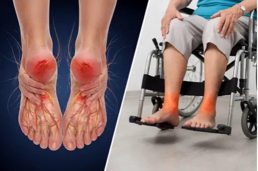 Burning Feet At Night: Symptoms, Causes & Relief